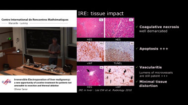 Irreversible electroporation of liver malignancy: a new opportunity of curative treatment for patients not amenable to resection and thermal ablation