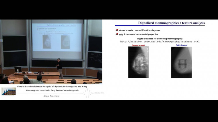 Wavelet-based multifractal analysis of dynamic infrared thermograms and X-ray mammograms to assist in early breast cancer diagnosis